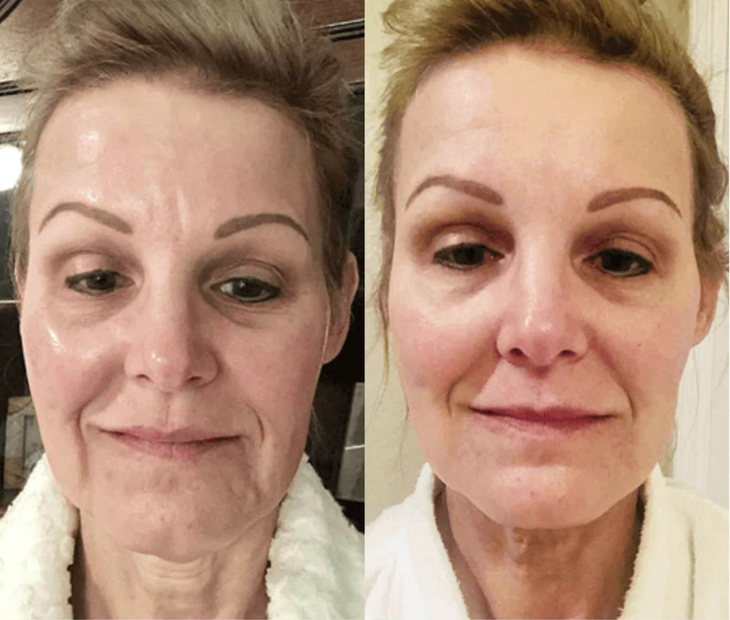Iris, 61