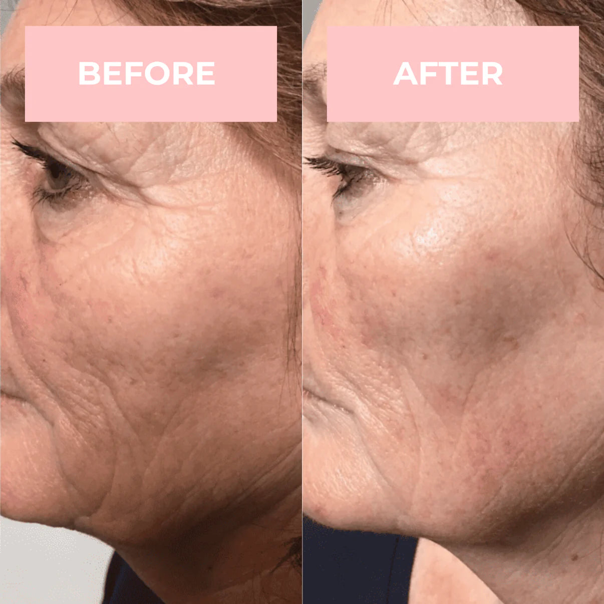4-in-1 High Frequency Wand - Aurora Skin