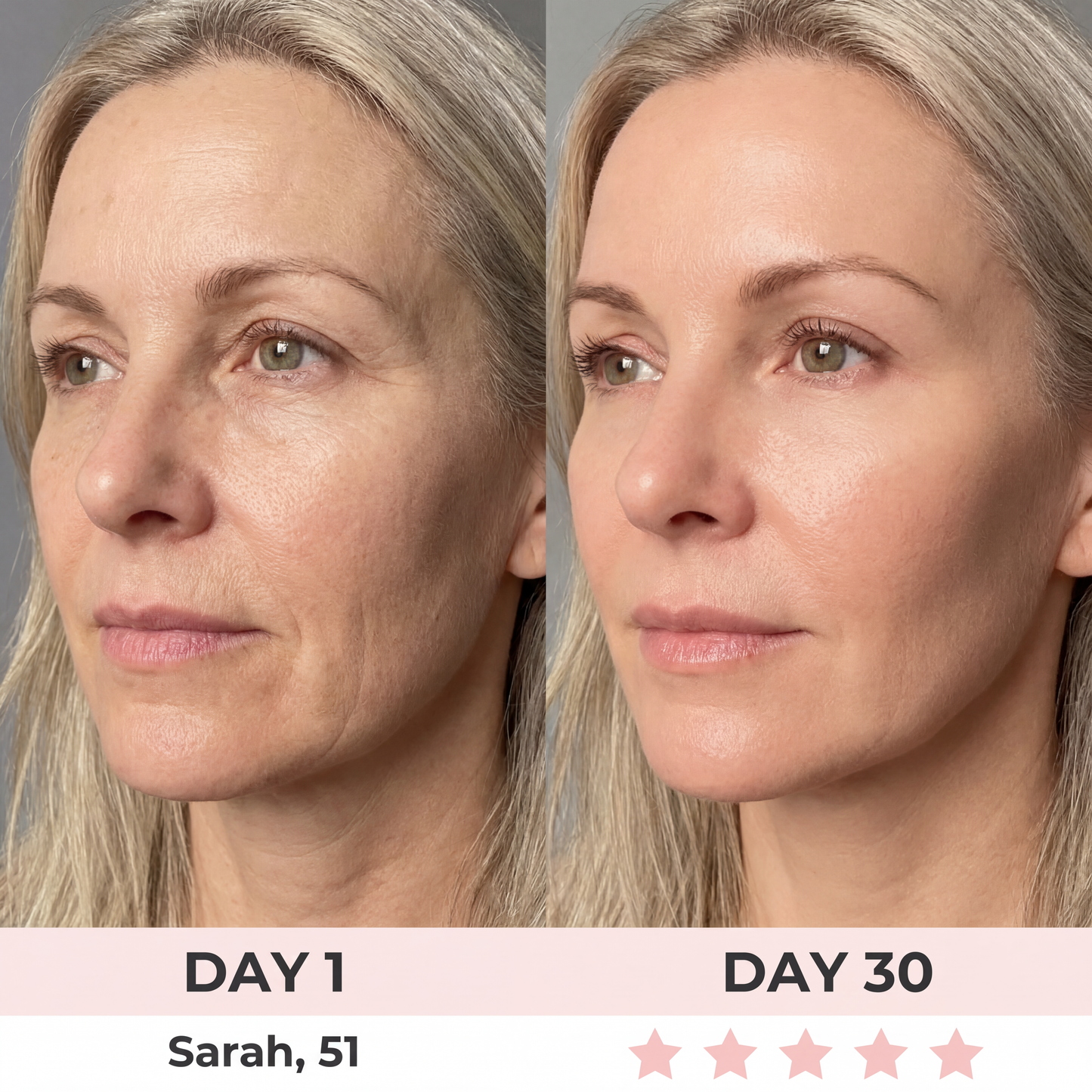 AURORA 7-in-1 LED Facial Sculptor