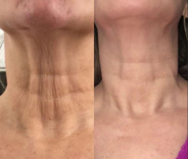 Nicole, 52