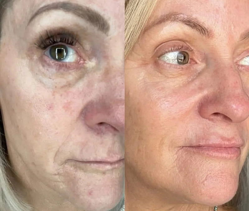 Joan, 64
