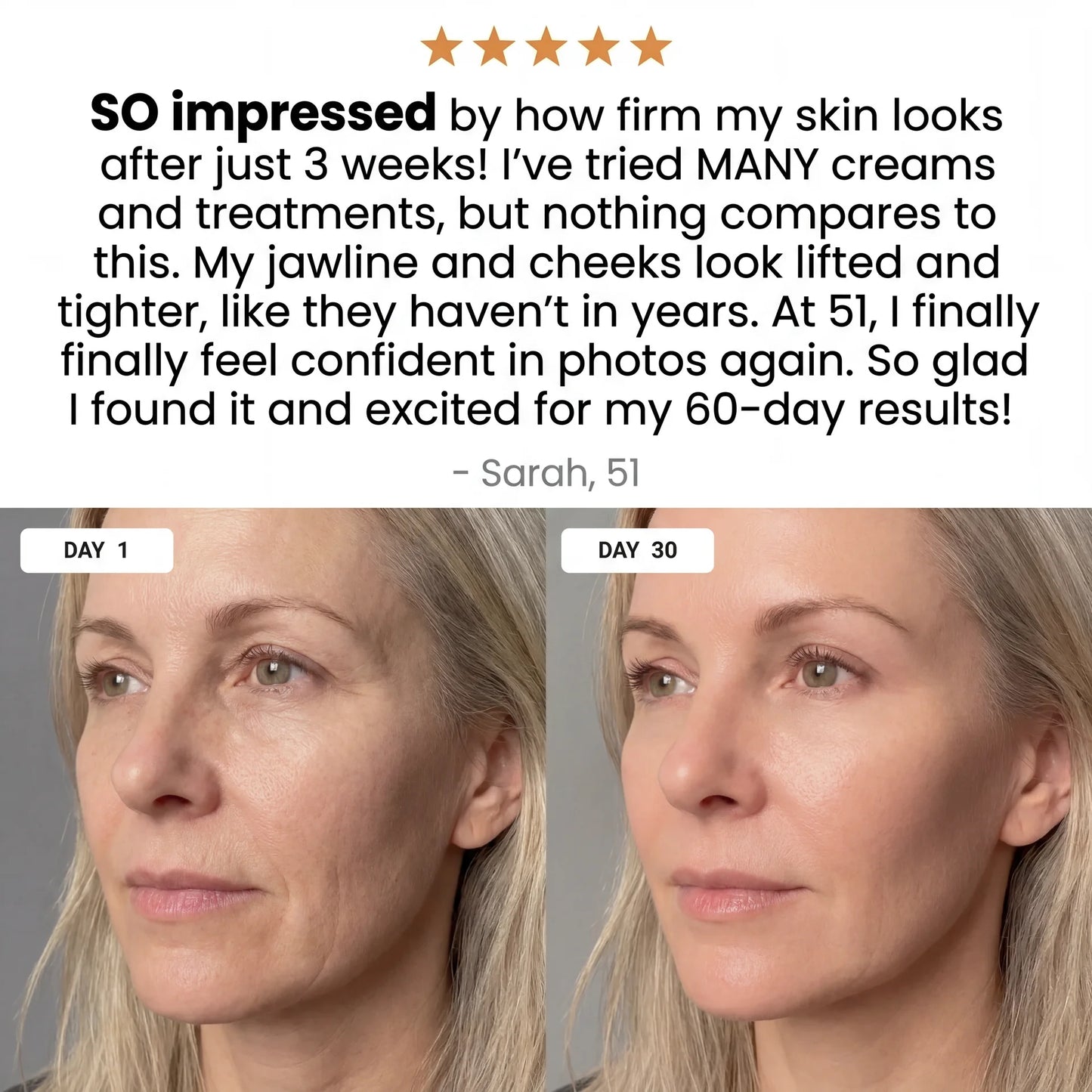 AURORA 7-in-1 LED Facial Sculptor