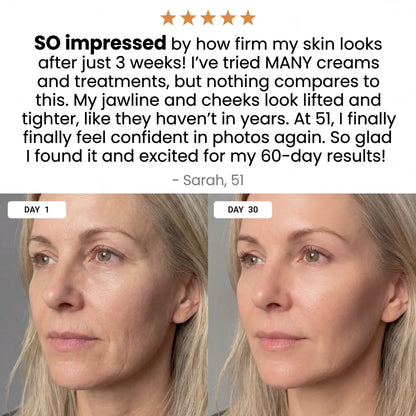 AURORA 7-in-1 LED Facial Sculptor