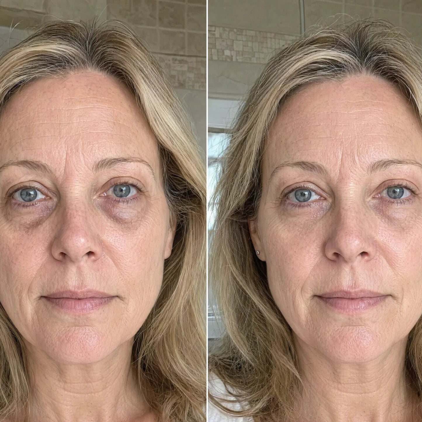 AuroraEyes™ Under Eye Red Light Therapy